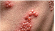 ��״����Ĳ���-��״������ô���ƣ�