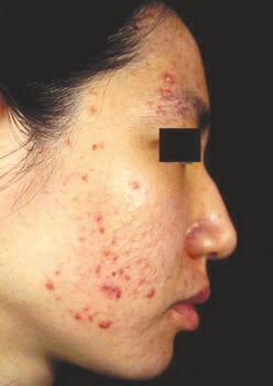 Çà´º¶»Æ½Ê±ÎÒÃÇÒªÔõôȥµ÷Àí