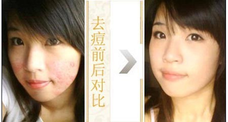 �ϲ���ɽƤ����ҽԺ