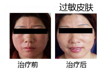 ������Ƥ�׿�������