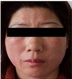 ������Ƥ��