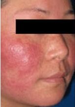 ������Ƥ�׶���ܺ�