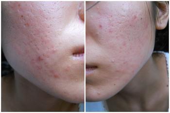 �ഺ�������ƶ������Σ��