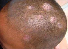 С����Ѣ���Ԥ��