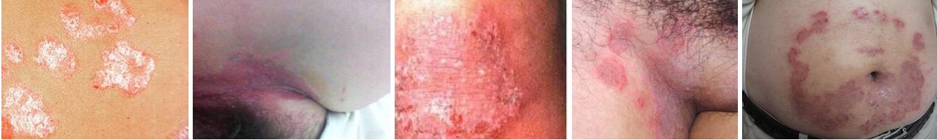 ��Ѣ����������Щ