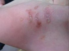 ����Ѣ�Ļ���ԭ������Щ