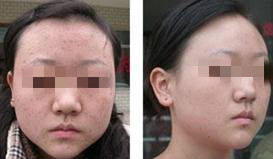 ��ƽ�����ƶԱ�