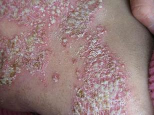 ţƤѢ������Ҫע��ʲô