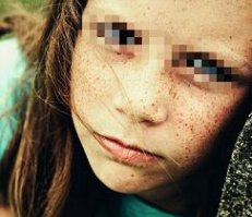 ȸ�ߵĳ���֢״��ʲô