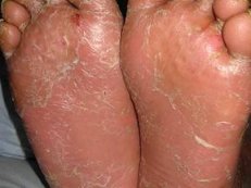 ����ţƤѢ������ԭ����ʲô