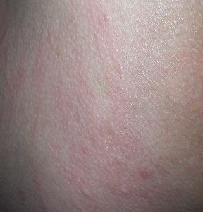 ����Ƥ�׻��ߵ���ʳ��������Щ