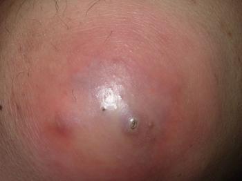 ë���׵�Σ��