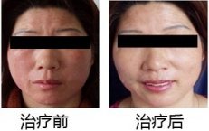 ���Ƥ�� �һ����µ�����