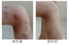 �����Ȳ�Ƥ����������