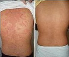 ����֬����Ƥ�����ҹ������м���