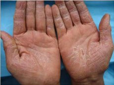 �ϲ���ʪ��������Ʒ���