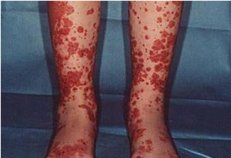 ��������񰶼����Щ֢״��?