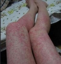 ���������ķ���ԭ����ʲô?