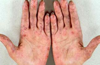 ����������֢״����