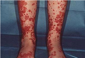 ����ҪԤ�����������