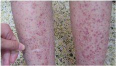 ���������Ӧ������Щ���