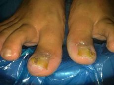 ʲô�Ǽ��Լ׹���