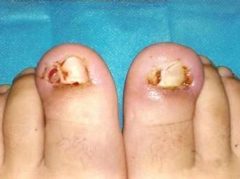 �׹��׵�ԭ��������