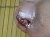 �׹��ײ��λᵼ��ʲô�����