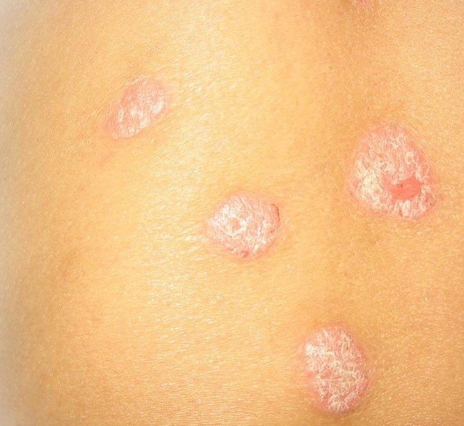 ţƤѢ��ô�������