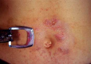 �Ӵ���Ƥ�׵Ĳ����ص�