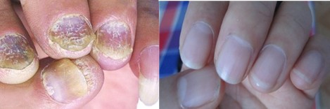 �ϲ����ƻ�ָ������Ч���Ʒ�