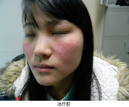 ��������Ƥ��������ʳ������Щ