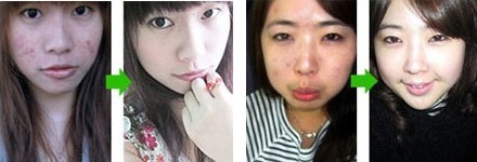 ìǰºó¶Ô±Èͼ