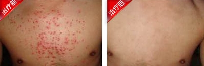 皮肤过敏症状图