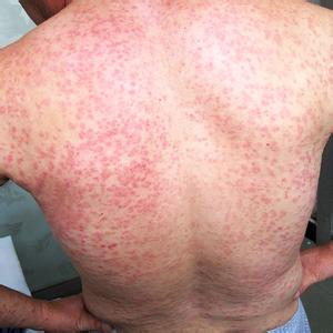 õ�忷����ʲô����