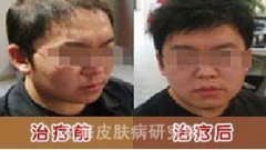 õ�忷�����ƴ�ʩ