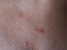 ���ë�ܽǻ���Ԫ������Щ��