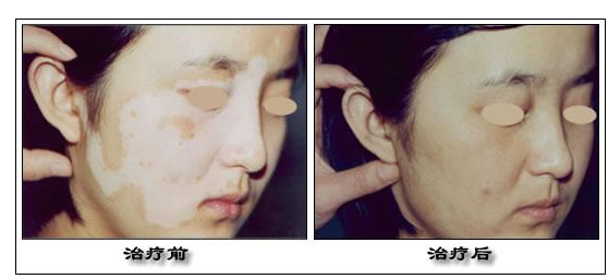 �ΰ�������Ч�ķ���