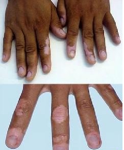 �ֱ�����ɰװߵ�ԭ��