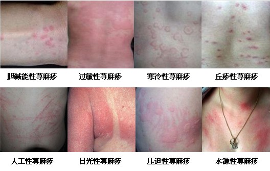 ݡ����֢״����