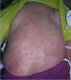 ʪ������彡����ʲôΣ��