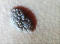 Ѱ����Ի�����ʲôΣ��