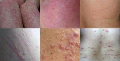 Ƥ������