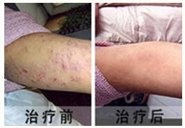 ʪ�������