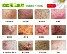 �ഺ����֢״���Ѽ�����ѯ�����ഺ������