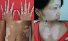 �������Ҫ֢״����