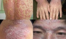 ����ţƤѢ�û�����Ǯ